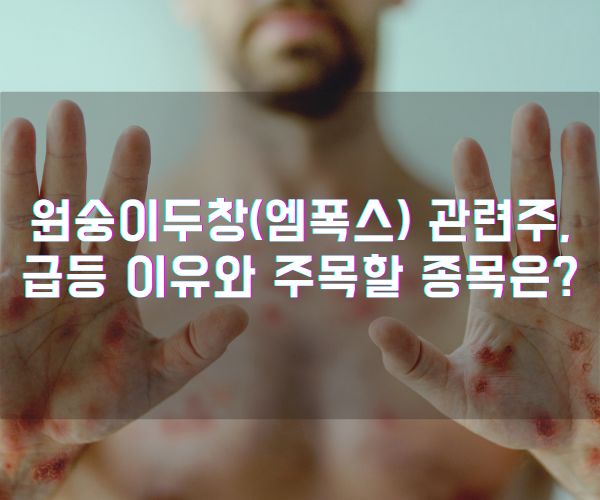 원숭이두창(엠폭스) 관련주, 급등 이유와 주목할 종목은?